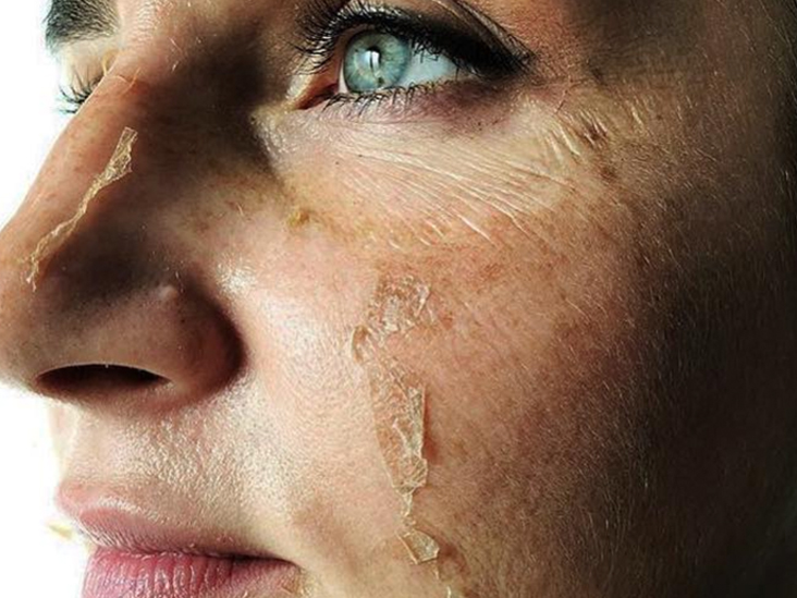 Modern Procedures Can Help You Achieve Perfection