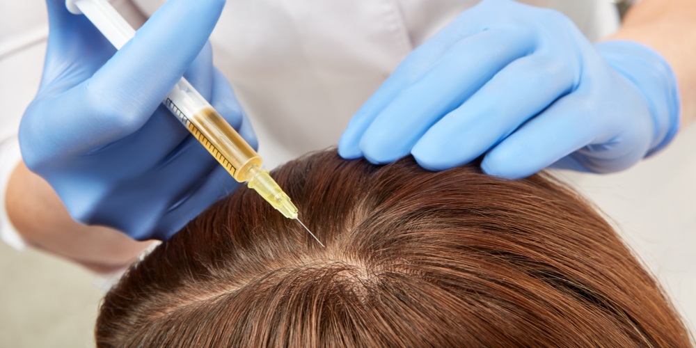 PRP Hair Restoration Treatment – Here’s a Guide on What You Should Expect 